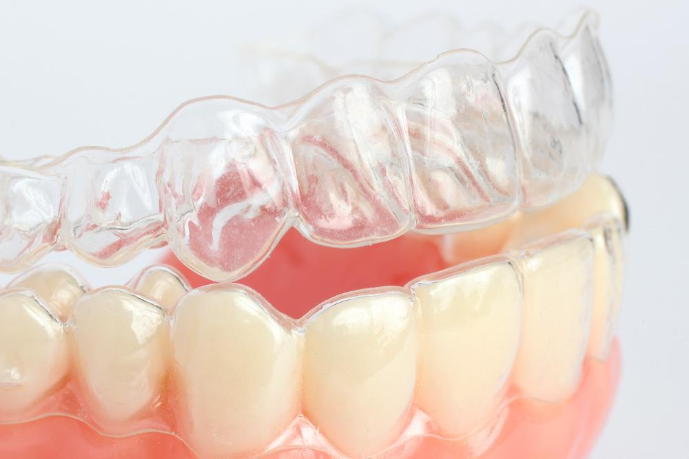 Invisalign in the teeth