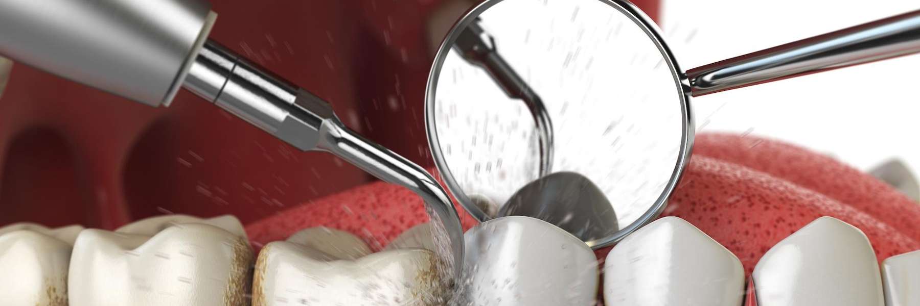 dental exam knoxville tn