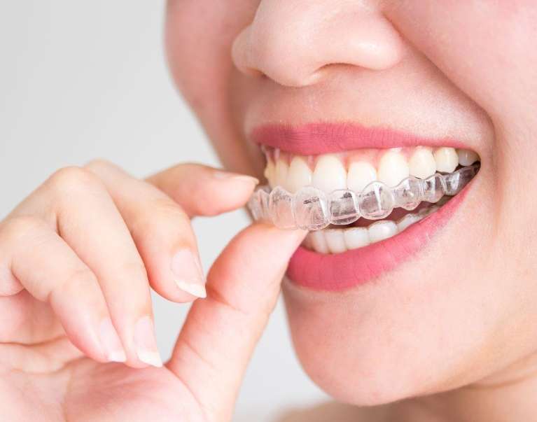 woman holding her Invisalign®