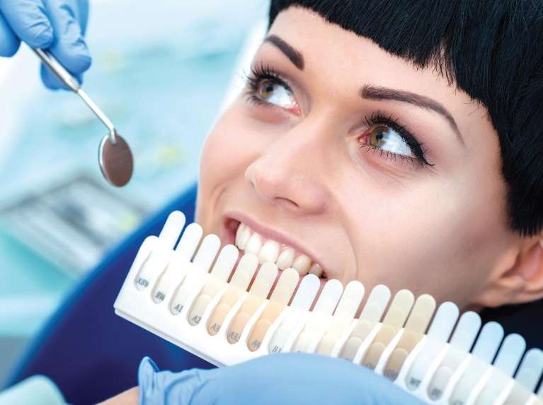 teeth whitening shades