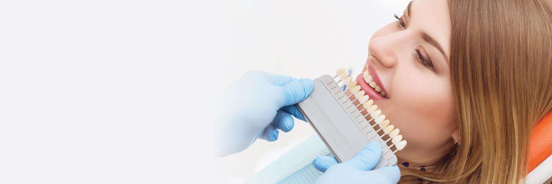teeth whitening shades