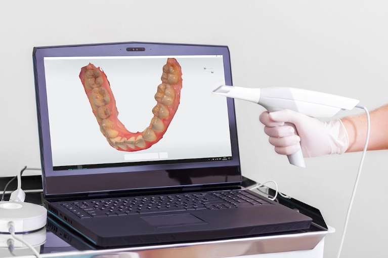 Digital Impressions to tkae 3d scans of the mouth