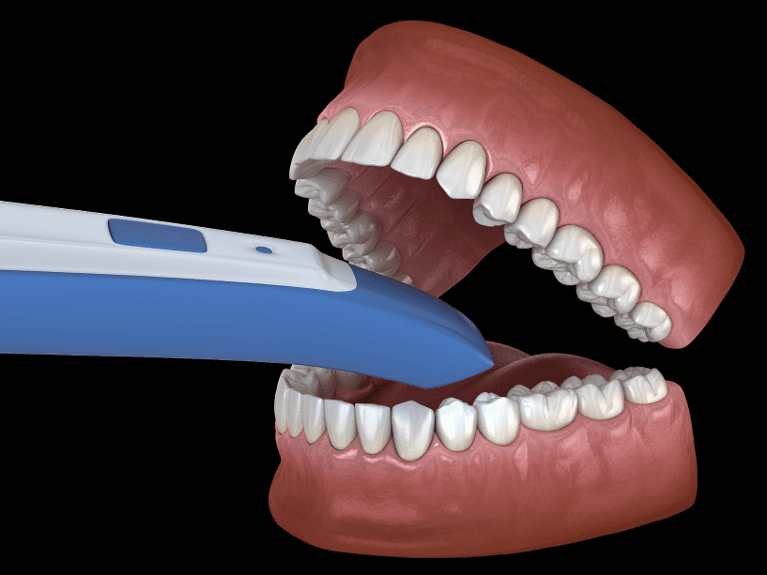 iTero Scanner